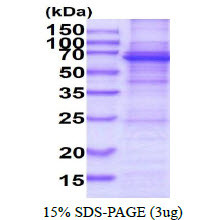 SDS-PAGE gel of recombinant human DDX56 protein under reducing conditions stained with Coomassie blue