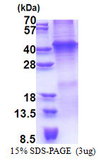 SDS-PAGE of recombinant human Wnt-7a protein under reducing conditions Coomassie stain