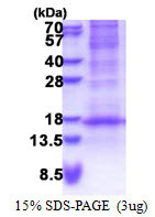 SDS-PAGE gel of recombinant human DEFB116 protein under reducing conditions stained with Coomassie blue