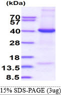 SDS-PAGE gel of recombinant human eIF-3 beta EIF3I protein under reducing conditions