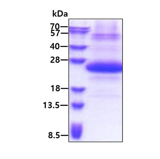 SDS-PAGE gel of recombinant human SSSCA1 ZNRD2 protein under reducing conditions Coomassie blue stain