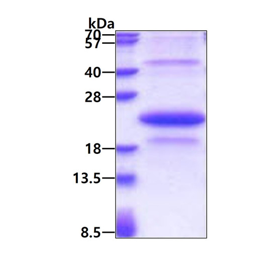 SDS-PAGE gel showing recombinant human TNFRSF27 EDA2R protein under reducing conditions