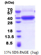 SDS-PAGE gel showing recombinant human DNALI1 protein under reducing conditions stained with Coomassie blue