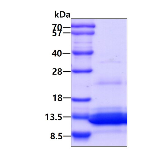 SDS-PAGE gel of recombinant human TRIAP1 protein under reducing conditions Coomassie blue stain