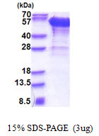 SDS-PAGE gel of recombinant human Dynactin Subunit 2 DCTN2 protein under reducing conditions
