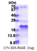 SDS-PAGE gel of recombinant human SHFM1 protein stained with Coomassie blue