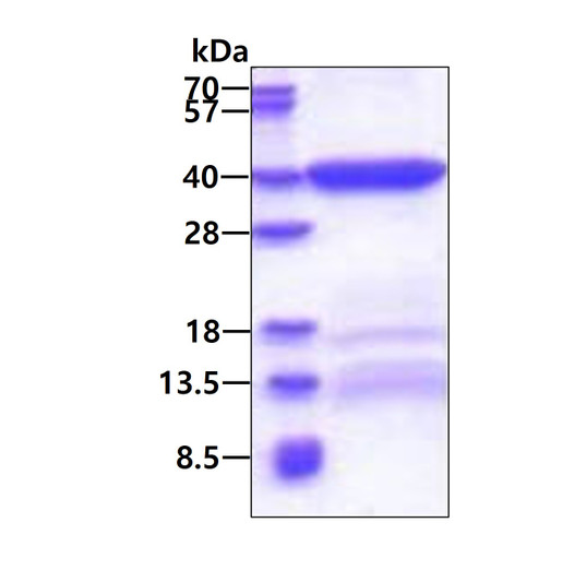 SDS-PAGE gel of recombinant human BEND6 protein 3 µg under reducing conditions Coomassie blue stain