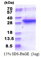 SDS-PAGE gel showing 3 µg recombinant human DCI ECI1 protein under reducing conditions with Coomassie blue stain