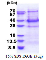 SDS-PAGE gel of recombinant human BCL7C protein under reducing conditions Coomassie blue stain