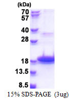 SDS-PAGE of recombinant human DEFB118 protein under reducing conditions with Coomassie blue stain