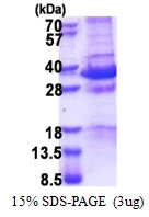 SDS-PAGE gel of recombinant human NRAGE protein under reducing conditions with Coomassie blue stain