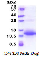 SDS-PAGE of recombinant human UQCRH protein under reducing conditions stained with Coomassie blue