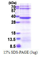 SDS-PAGE gel of recombinant human NSDHL protein under reducing conditions