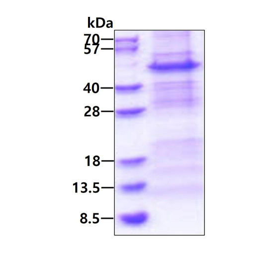 Recombinant human NDUFS2 protein SDS-PAGE gel under reducing conditions