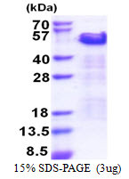 SDS-PAGE gel of recombinant human TRIP10 protein under reducing conditions stained with Coomassie blue