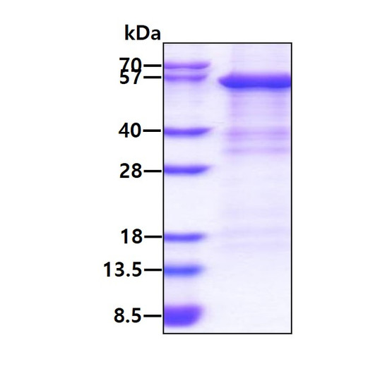SDS-PAGE of recombinant human Complement Factor B protein under reducing conditions