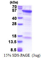 SDS-PAGE gel of recombinant human CUEDC1 protein under reducing conditions Coomassie blue stain