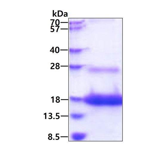 SDS-PAGE gel showing recombinant human LY6D protein 3µg under reducing conditions with Coomassie blue stain