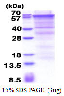 SDS-PAGE of recombinant human Endoglin CD105 protein under reducing conditions Coomassie blue stain