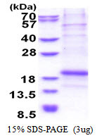 SDS-PAGE of recombinant human Chondromodulin LECT1 protein 3µg reducing conditions Coomassie blue stain