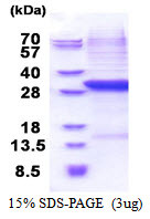 SDS-PAGE gel of recombinant human Complement Factor B protein under reducing conditions Coomassie blue stain