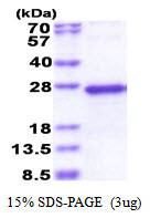SDS-PAGE gel of recombinant human NDUFS5 protein under reducing conditions
