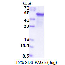 SDS-PAGE gel of recombinant human EPHX1 protein under reducing conditions Coomassie stained