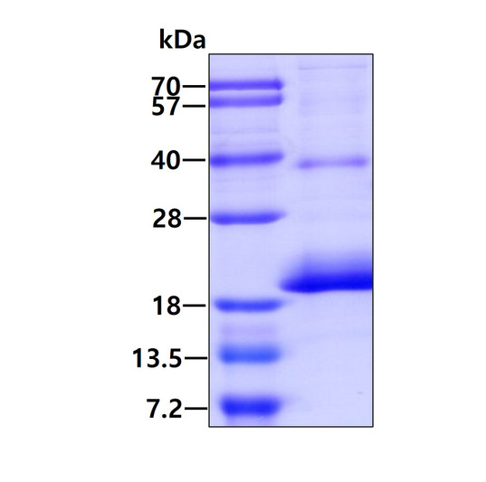 SDS-PAGE gel of recombinant human CD164L2 protein under reducing conditions stained with Coomassie blue