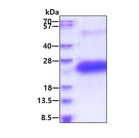 SDS-PAGE of recombinant human CD40 TNFRSF5 protein under reducing conditions stained with Coomassie blue