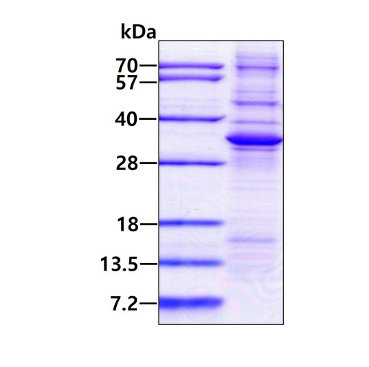 SDS-PAGE gel of recombinant human ADAL protein 3µg under reducing conditions Coomassie blue stain