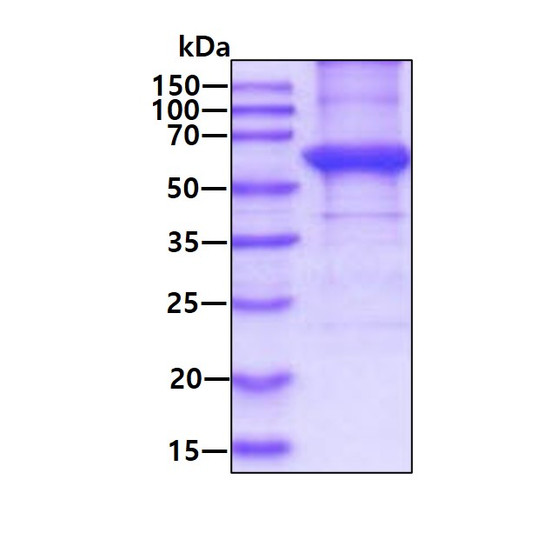 SDS-PAGE gel of recombinant human KRT5 protein 3μg under reducing conditions with Coomassie blue stain