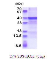 SDS-PAGE gel of recombinant human ZWINT protein under reducing conditions stained with Coomassie blue
