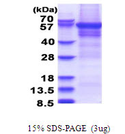 SDS-PAGE gel showing recombinant human CPEB1 protein under reducing conditions Coomassie blue stain