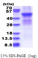 SDS-PAGE gel of recombinant human PKA C beta PRKACB protein under reducing conditions