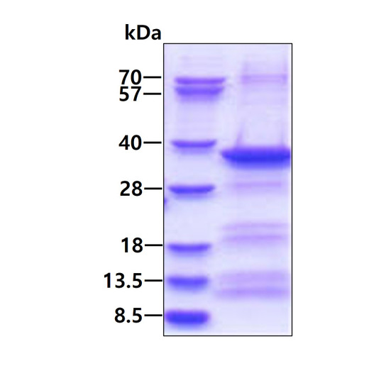 SDS-PAGE gel of recombinant human EXOSC3 protein under reducing conditions Coomassie blue stain