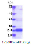 SDS-PAGE gel of recombinant human COA4 protein under reducing conditions Coomassie blue stain