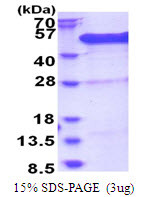 SDS-PAGE gel of recombinant human BCCIP protein under reducing conditions stained with Coomassie blue