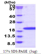 SDS-PAGE gel of recombinant human POP7 protein under reducing conditions stained with Coomassie blue