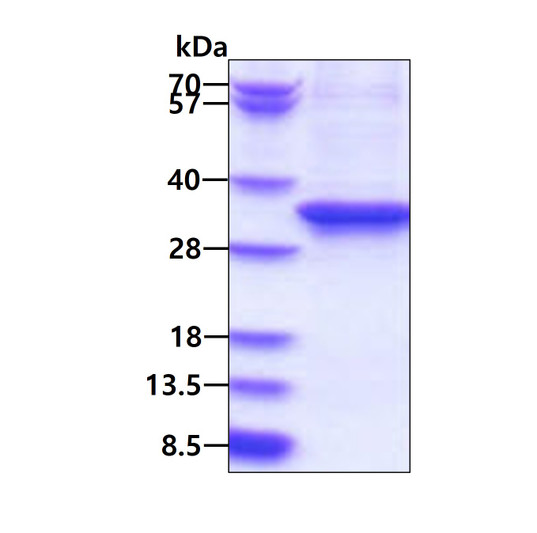 SDS-PAGE of recombinant human EEF2 protein under reducing conditions Coomassie blue stain