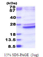 SDS-PAGE gel of recombinant human B9D2 protein under reducing conditions stained with Coomassie blue