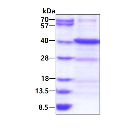 Recombinant human ANKRA2 protein SDS-PAGE gel 3µg reducing conditions Coomassie blue stain