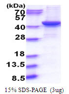 SDS-PAGE gel of recombinant human GNAQ protein under reducing conditions stained with Coomassie blue