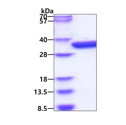 SDS-PAGE of recombinant E. coli GLK protein under reducing conditions Coomassie blue stain