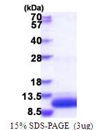 SDS-PAGE of recombinant human GNGT1 protein 3μg under reducing conditions with Coomassie blue stain