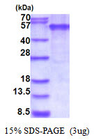 SDS-PAGE of recombinant human EDAR protein under reducing conditions Coomassie blue stain