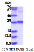 SDS-PAGE gel of recombinant human GLTPD1 protein under reducing conditions