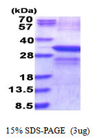 SDS-PAGE gel of recombinant human LOX protein 3 µg under reducing conditions stained with Coomassie blue