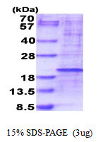 SDS-PAGE gel of recombinant human RPL35 protein 3µg under reducing conditions Coomassie blue stain
