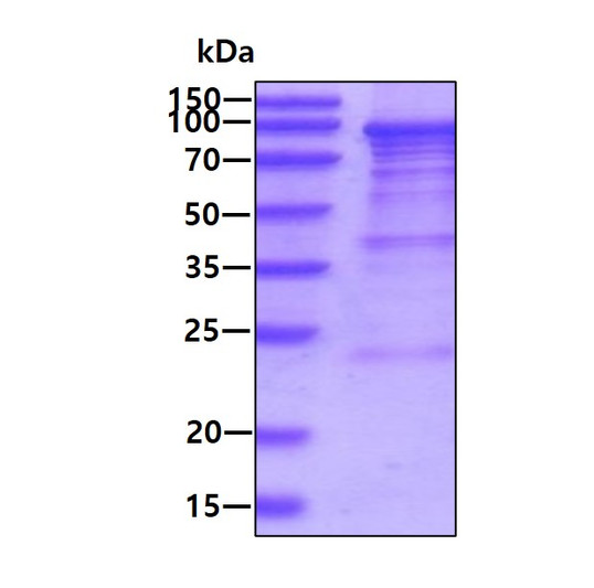 SDS-PAGE gel of recombinant human eEF-2K EEF2K protein 3µg under reducing conditions Coomassie blue stain