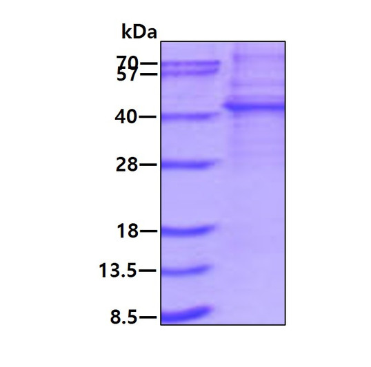 SDS-PAGE gel showing recombinant human KLHDC8B protein 3µg under reducing conditions stained with Coomassie blue